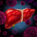 Important Things to Know About Cancer Stage 1 – Oren Zarif