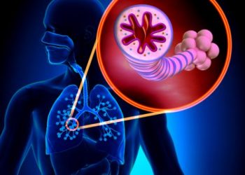 How Often Should You Have Cervical Cancer Screening? – Oren Zarif