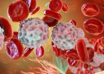 Early-Stage Colon Cancer Involves Removing the Cancer – Oren Zarif