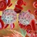 Early-Stage Colon Cancer Involves Removing the Cancer – Oren Zarif