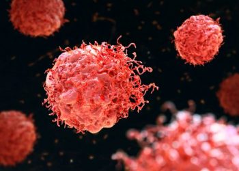 Testicles Cancer – Why Men Get Testicular Cancer – Oren Zarif