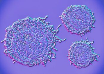 Symptoms of Testicular Cancer is an Enlarged Testicle – Oren Zarif