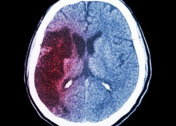 Cancer of the Endometrium – Risk Factors – Oren Zarif