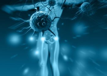 Anal Cancer Treatment – Oren Zarif