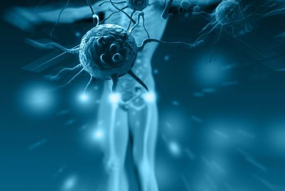 Anal Cancer Treatment – Oren Zarif