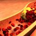 Cancer in the Anus Symptoms – Oren Zarif
