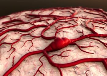 Head and Neck Cancer Stages – Oren Zarif