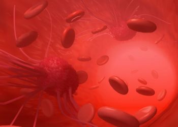 Treatments for Triple Negative Breast Cancer – Oren Zarif