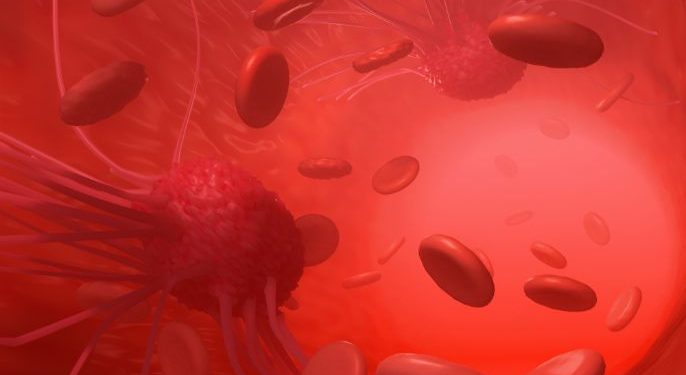 Treatments for Triple Negative Breast Cancer – Oren Zarif