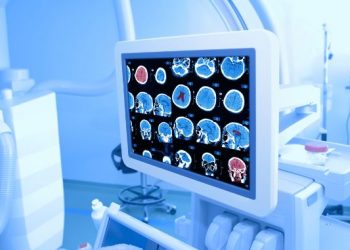 Pancreas Cancer Symptoms and Treatments – Oren Zarif