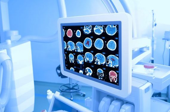 Pancreas Cancer Symptoms and Treatments – Oren Zarif