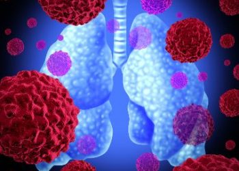 Rectal Cancer – Symptoms, Risk, and Treatment – Oren Zarif