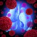 Rectal Cancer – Symptoms, Risk, and Treatment – Oren Zarif