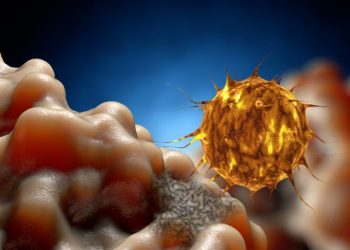 What is the Cause of Prostate Cancer? – Oren Zarif