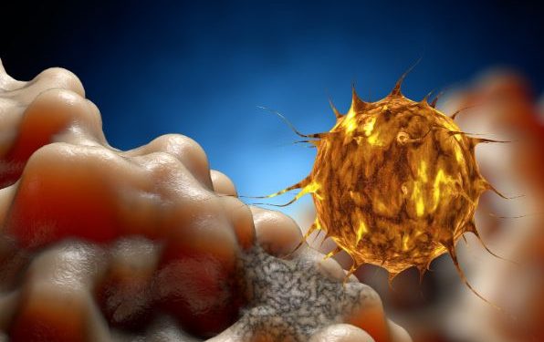 What is the Cause of Prostate Cancer? – Oren Zarif