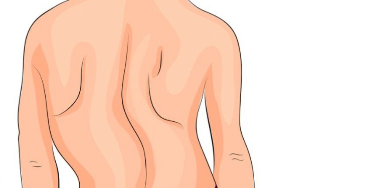 Cancer Stage 4 Symptoms – Oren Zarif