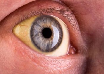 Cancer Stage 4 Symptoms – Oren Zarif