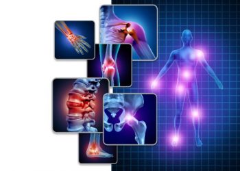 Cancer Stage 4 Symptoms – Oren Zarif