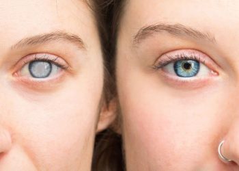 Cancer Stage 4 Symptoms – Oren Zarif