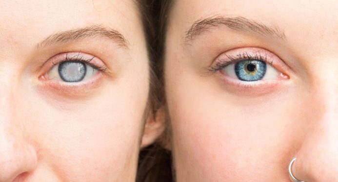 Cancer Stage 4 Symptoms – Oren Zarif