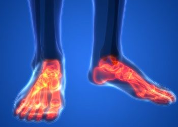 Legs Pain – Oren Zarif