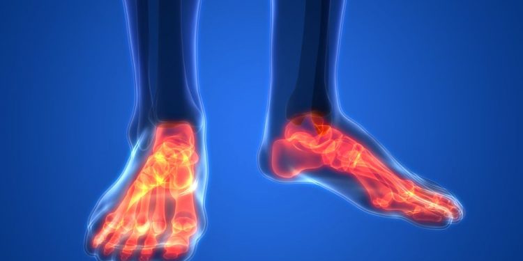 Legs Pain – Oren Zarif