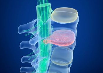 Abetalipoproteinemia