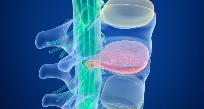 Abetalipoproteinemia