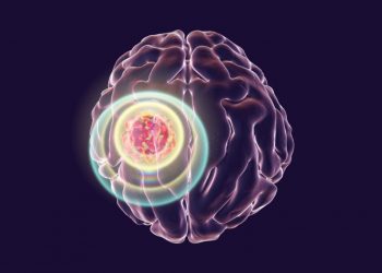 How to Beat Brain Cancer?