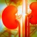 Kidney Stone