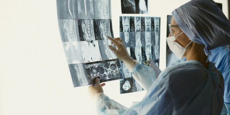 Stomach Cancer Symptoms