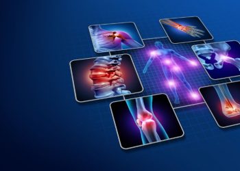 Fibromyalgia Symptoms