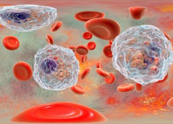 Symptoms of Eosinophilia