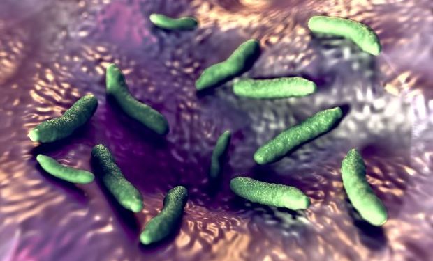 Symptoms of Ureoplasma Urealyticum