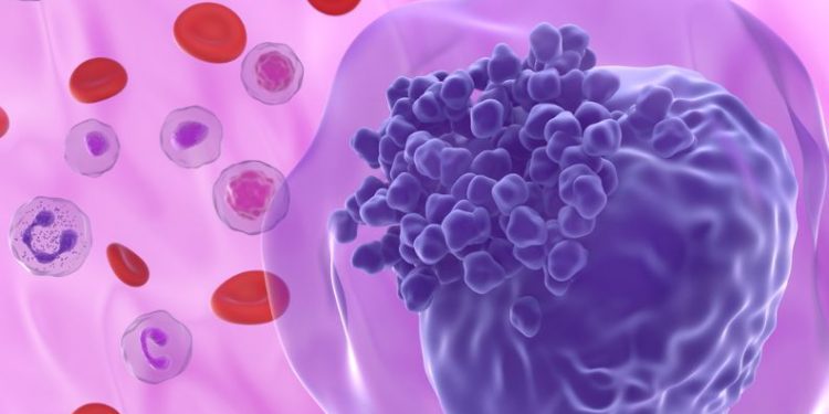 Symptoms of Leukemia