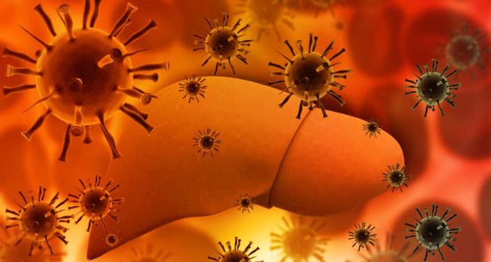 Symptoms of Liver Cancer