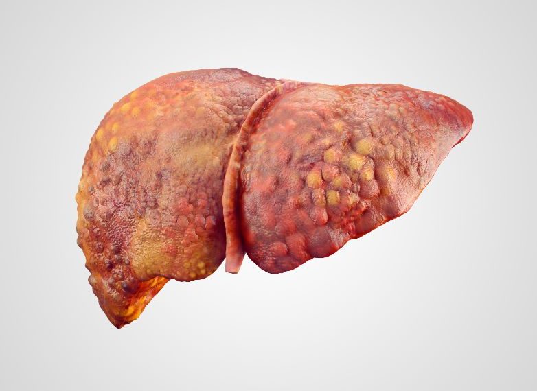 Hepatic Failure and Surgical Procedures