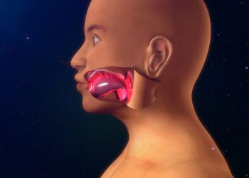 Angioedema Treatment