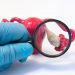 Anovulation Symptoms and Causes