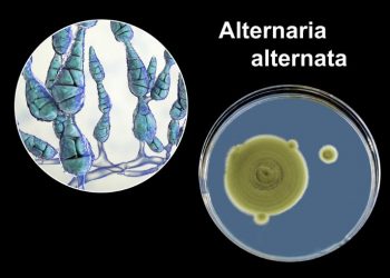 Alternaria Symptoms