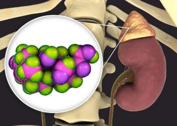 Aldosteronism Symptoms