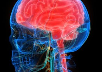 Transient Ischemic Attack Symptoms