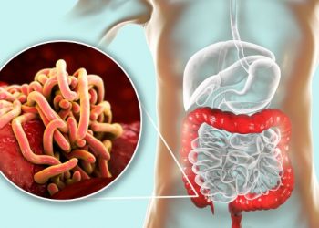 What Are Enterobius Vermicularis Symptoms?