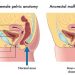 Anorectal Incontinence Symptoms and Treatments