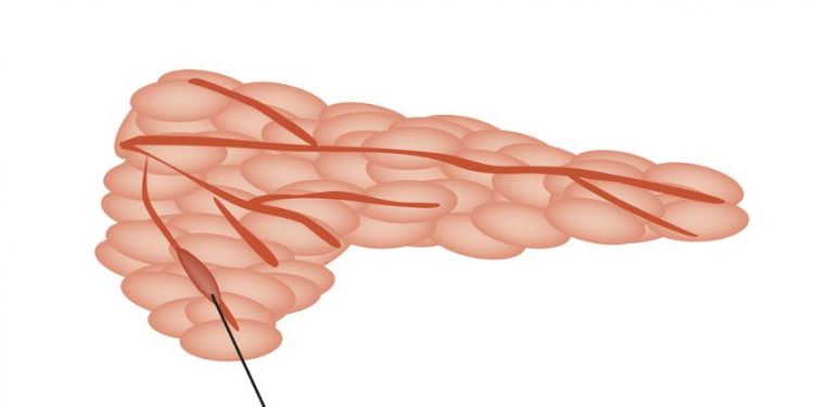 Exocrine Pancreatic Insufficiency