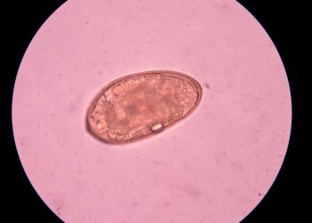 Schistosomiasis Treatments