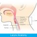 Larynx Tumors