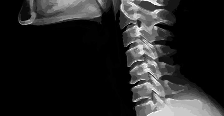 Head and Neck Primary Tumors Symptoms and Treatment