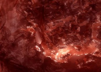 Granuloma Symptoms and Causes