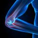 Bursitis Treatment